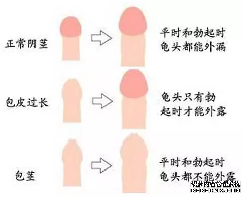 金华国庆节要割包皮,不然男人不行怎么过节？