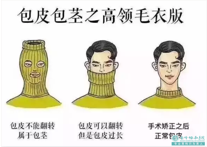 金华割包皮医院哪家好？早知早受益