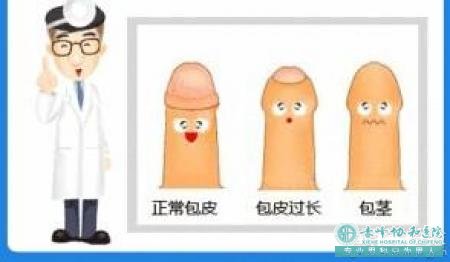 金华包皮手术：术前术后注意事项齐了!